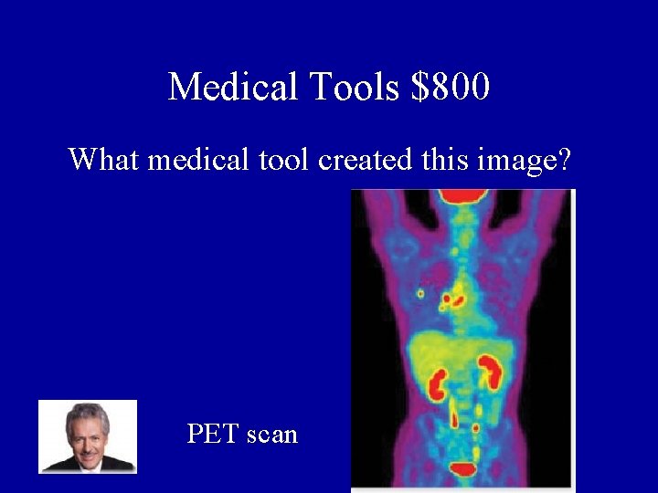 Medical Tools $800 What medical tool created this image? PET scan 