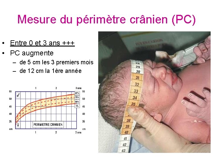 Mesure du périmètre crânien (PC) • Entre 0 et 3 ans +++ • PC