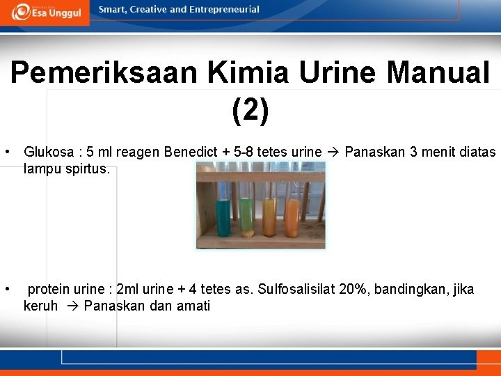 Pemeriksaan Kimia Urine Manual (2) • Glukosa : 5 ml reagen Benedict + 5