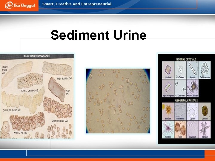 Sediment Urine 