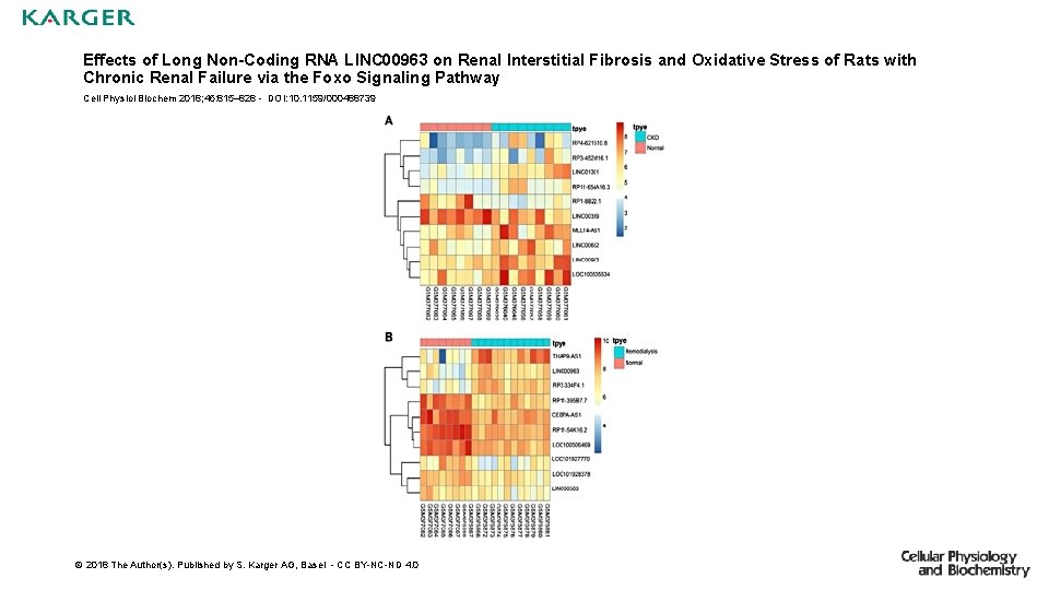 Effects of Long Non-Coding RNA LINC 00963 on Renal Interstitial Fibrosis and Oxidative Stress