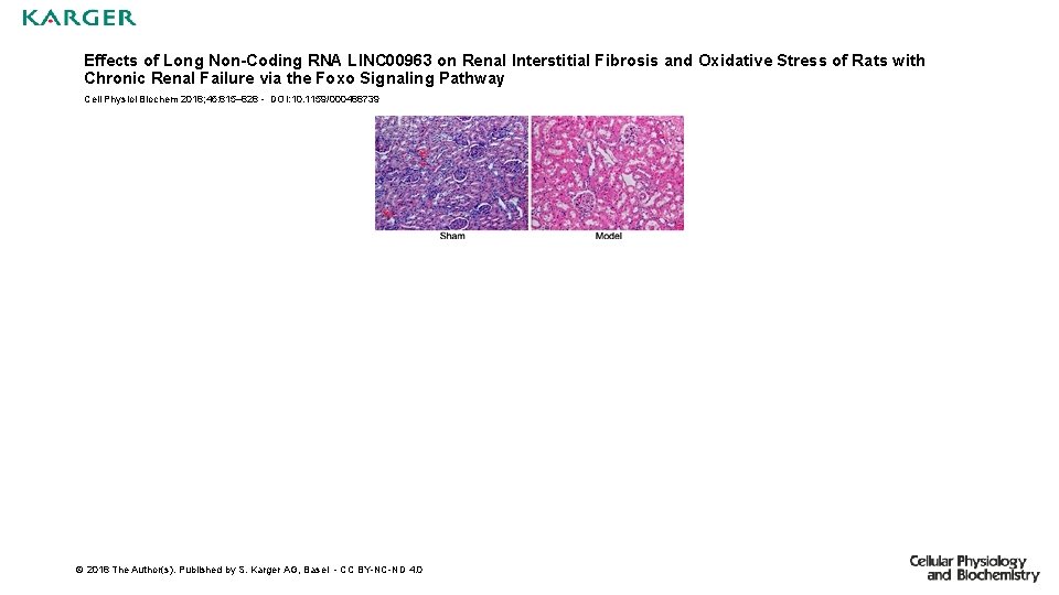 Effects of Long Non-Coding RNA LINC 00963 on Renal Interstitial Fibrosis and Oxidative Stress