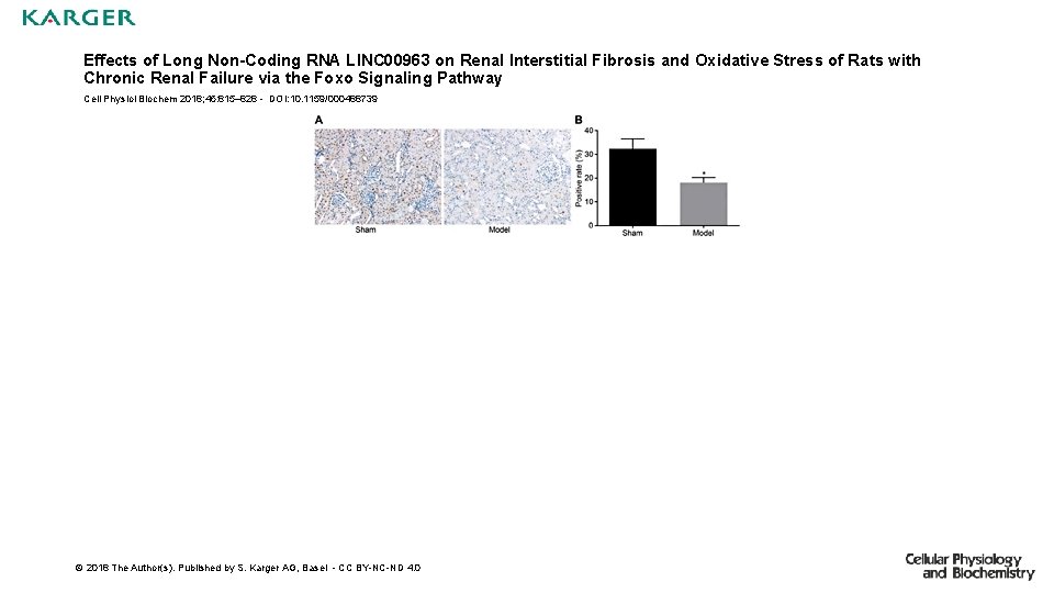 Effects of Long Non-Coding RNA LINC 00963 on Renal Interstitial Fibrosis and Oxidative Stress