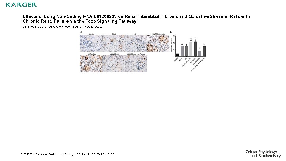 Effects of Long Non-Coding RNA LINC 00963 on Renal Interstitial Fibrosis and Oxidative Stress