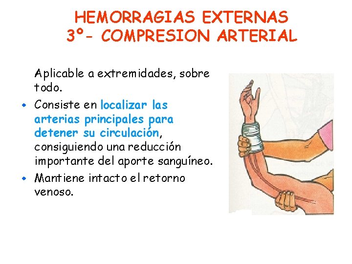 HEMORRAGIAS EXTERNAS 3º- COMPRESION ARTERIAL Aplicable a extremidades, sobre todo. w Consiste en localizar