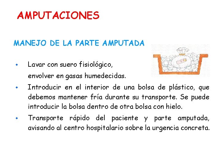 AMPUTACIONES MANEJO DE LA PARTE AMPUTADA w Lavar con suero fisiológico, envolver en gasas