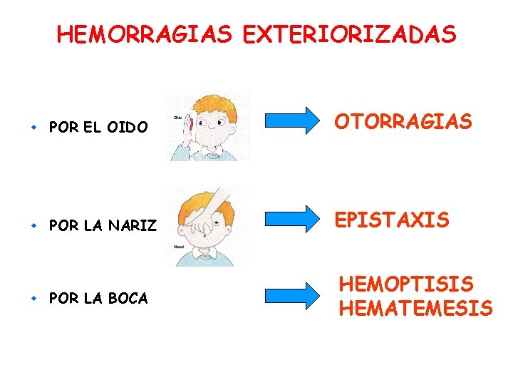 HEMORRAGIAS EXTERIORIZADAS w POR EL OIDO OTORRAGIAS w POR LA NARIZ EPISTAXIS POR LA