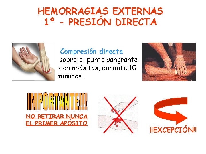 HEMORRAGIAS EXTERNAS 1º - PRESIÓN DIRECTA Compresión directa sobre el punto sangrante con apósitos,
