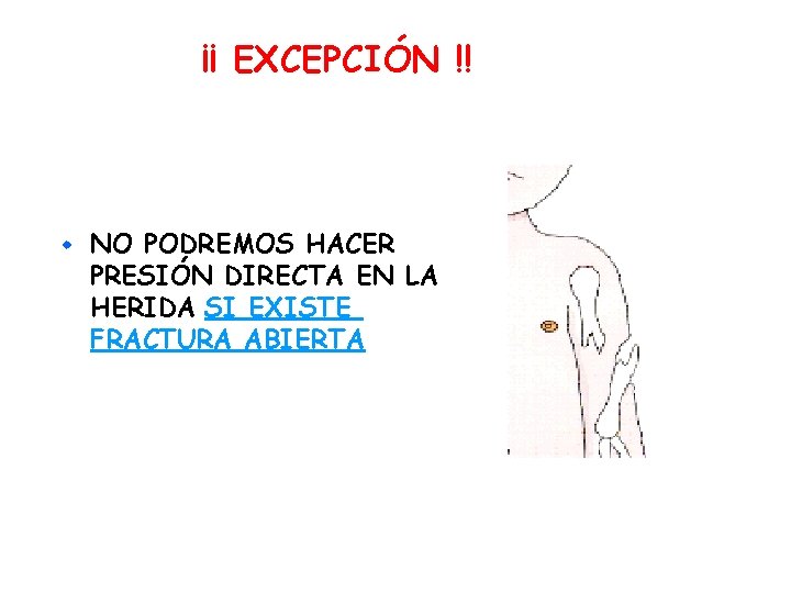 ¡¡ EXCEPCIÓN !! w NO PODREMOS HACER PRESIÓN DIRECTA EN LA HERIDA SI EXISTE