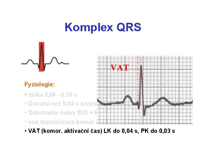 Komplex QRS Fyziologie: • délka 0, 06 - 0, 10 s • Q kratší