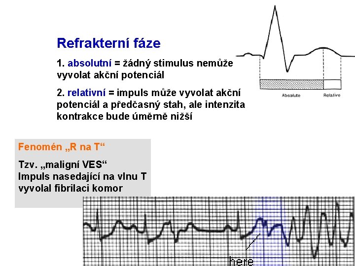 Refrakterní fáze 1. absolutní = žádný stimulus nemůže vyvolat akční potenciál 2. relativní =