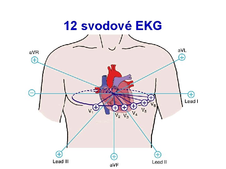 12 svodové EKG 