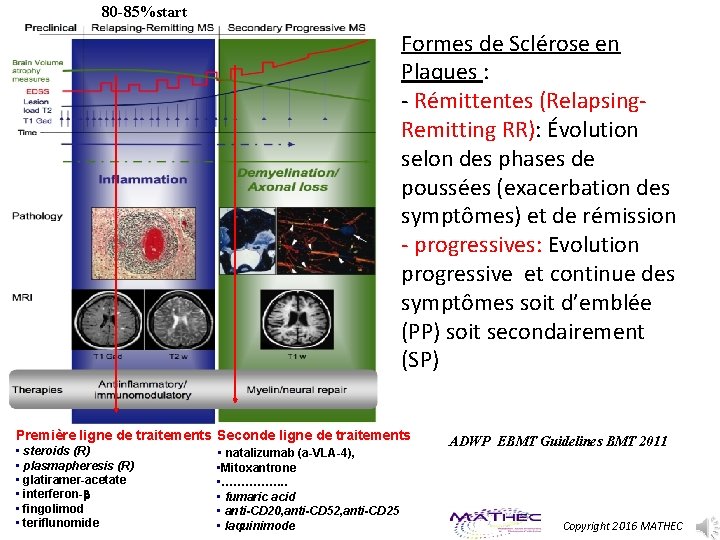 80 -85%start Formes de Sclérose en Plaques : ‐ Rémittentes (Relapsing‐ Remitting RR): Évolution