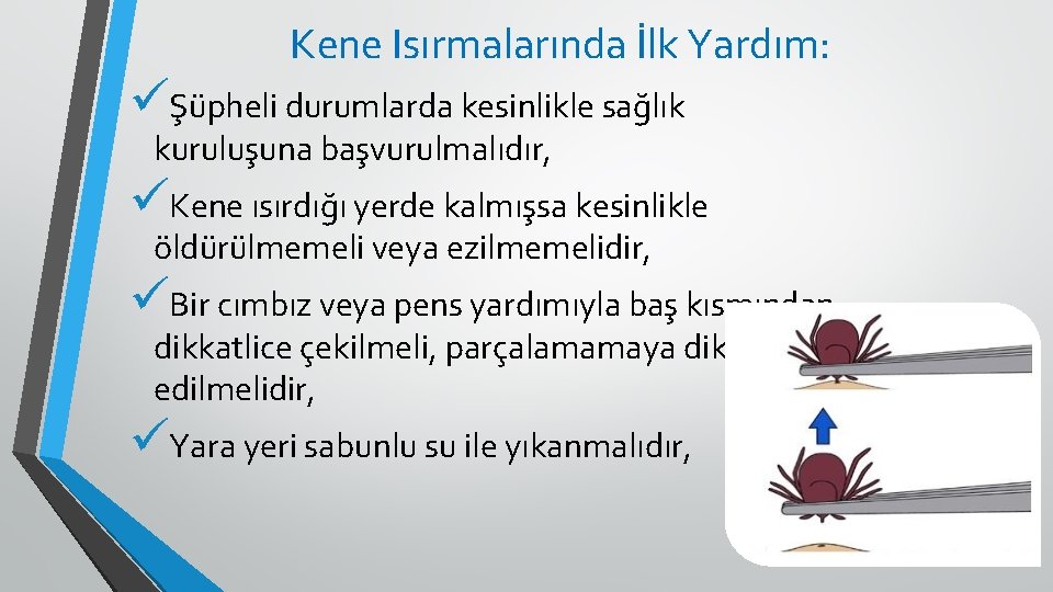 Kene Isırmalarında İlk Yardım: üŞüpheli durumlarda kesinlikle sağlık kuruluşuna başvurulmalıdır, üKene ısırdığı yerde kalmışsa