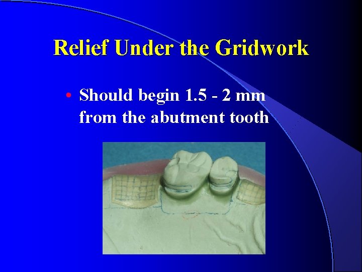 Relief Under the Gridwork • Should begin 1. 5 - 2 mm from the