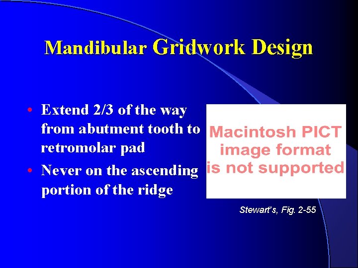 Mandibular Gridwork Design • Extend 2/3 of the way from abutment tooth to retromolar