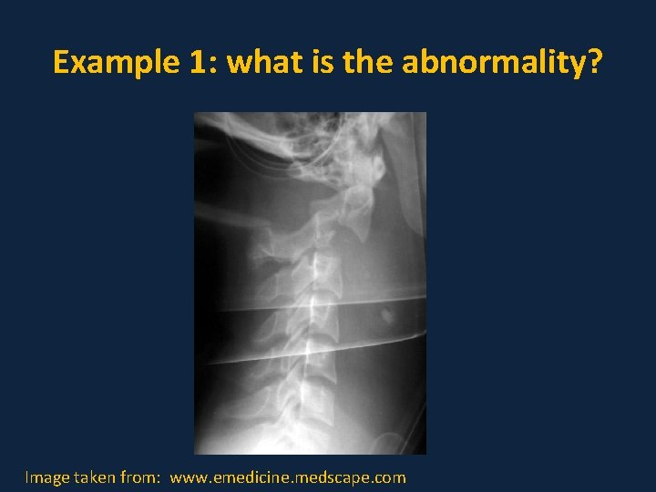 Example 1: what is the abnormality? Image taken from: www. emedicine. medscape. com 