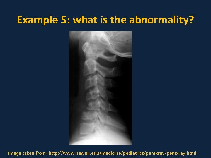 Example 5: what is the abnormality? Image taken from: http: //www. hawaii. edu/medicine/pediatrics/pemxray. html