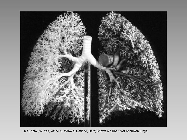 This photo (courtesy of the Anatomical Institute, Bern) shows a rubber cast of human