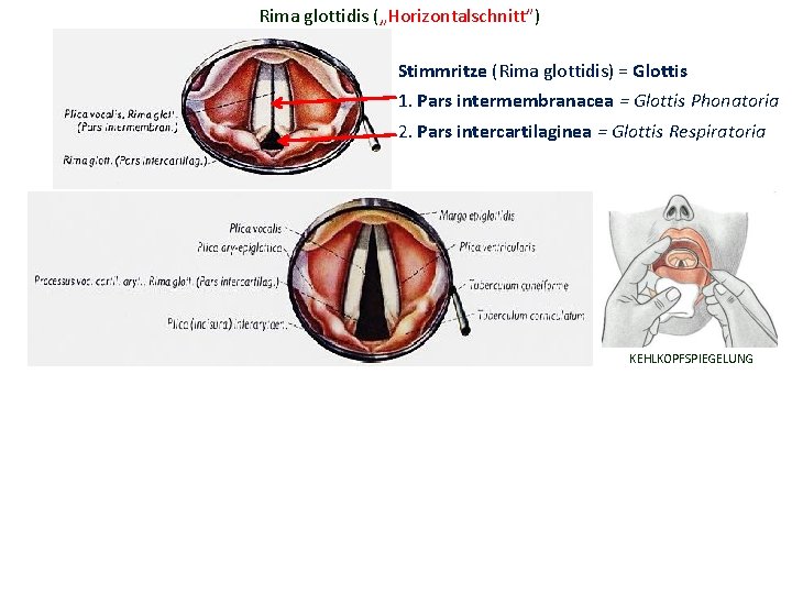 Rima glottidis („Horizontalschnitt”) Stimmritze (Rima glottidis) = Glottis 1. Pars intermembranacea = Glottis Phonatoria