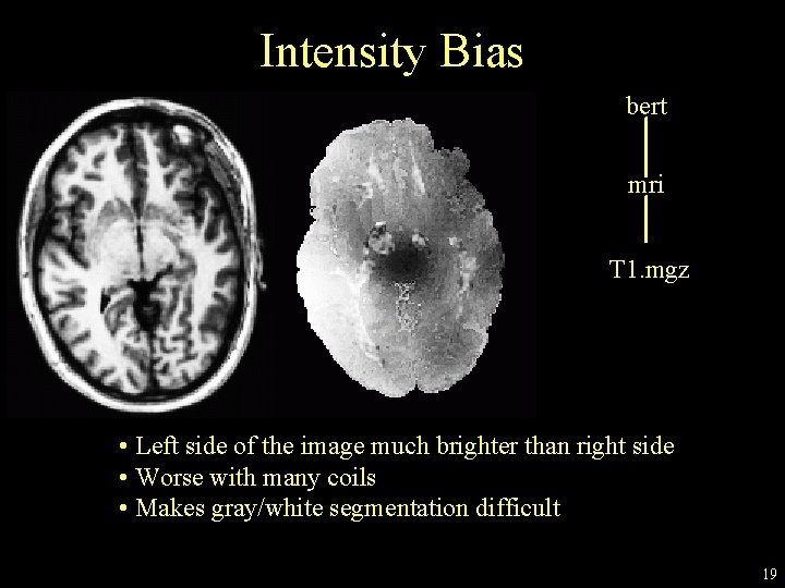 Intensity Bias bert mri T 1. mgz • Left side of the image much