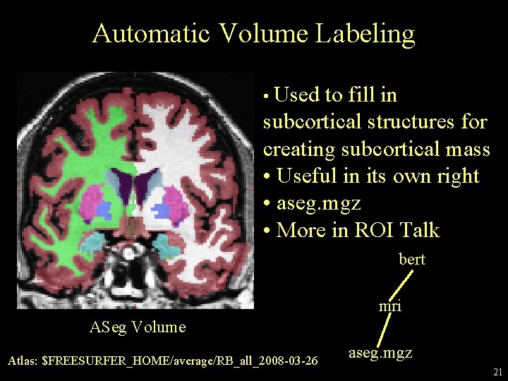 Automatic Volume Labeling • Used to fill in subcortical structures for creating subcortical mass