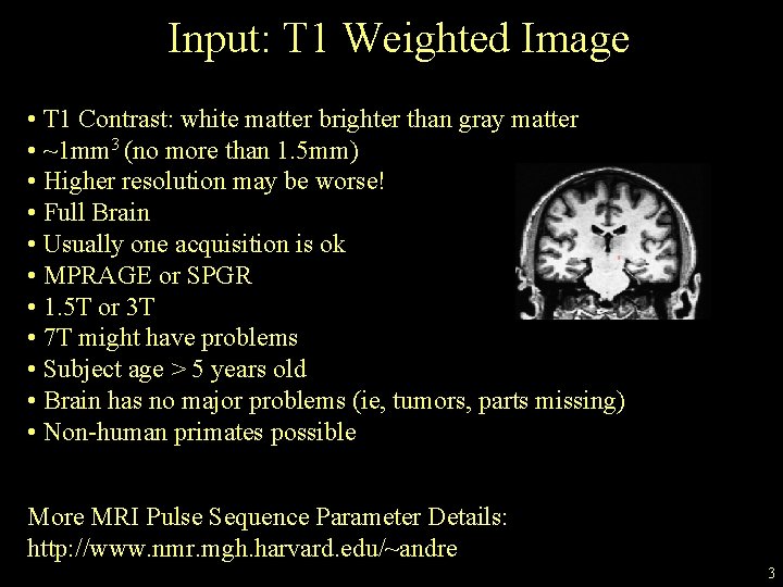 Input: T 1 Weighted Image • T 1 Contrast: white matter brighter than gray