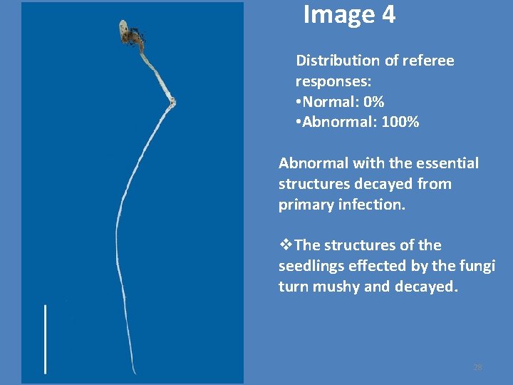 Image 4 Distribution of referee responses: • Normal: 0% • Abnormal: 100% Abnormal with