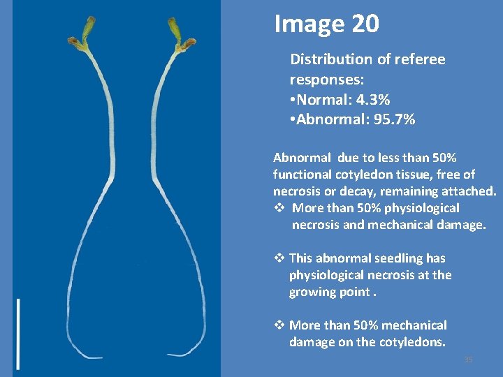 Image 20 Distribution of referee responses: • Normal: 4. 3% • Abnormal: 95. 7%