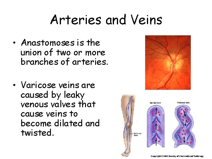 Arteries and Veins • Anastomoses is the union of two or more branches of