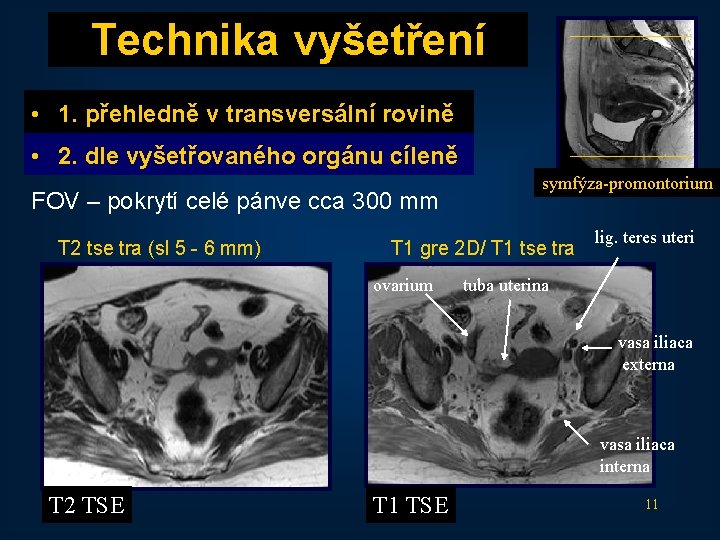 Technika vyšetření • 1. přehledně v transversální rovině • 2. dle vyšetřovaného orgánu cíleně