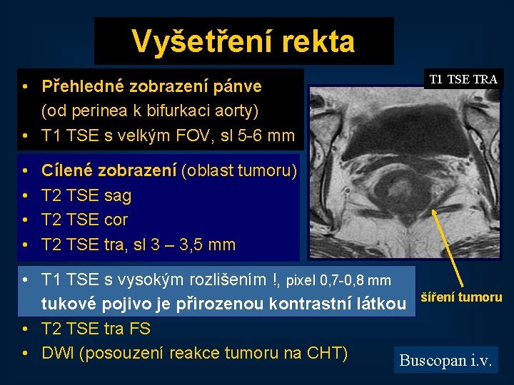 Vyšetření rekta • Přehledné zobrazení pánve (od perinea k bifurkaci aorty) • T 1