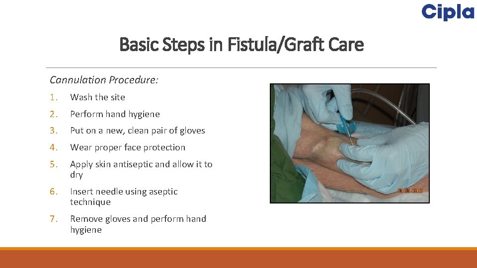 Basic Steps in Fistula/Graft Care Cannulation Procedure: 1. Wash the site 2. Perform hand