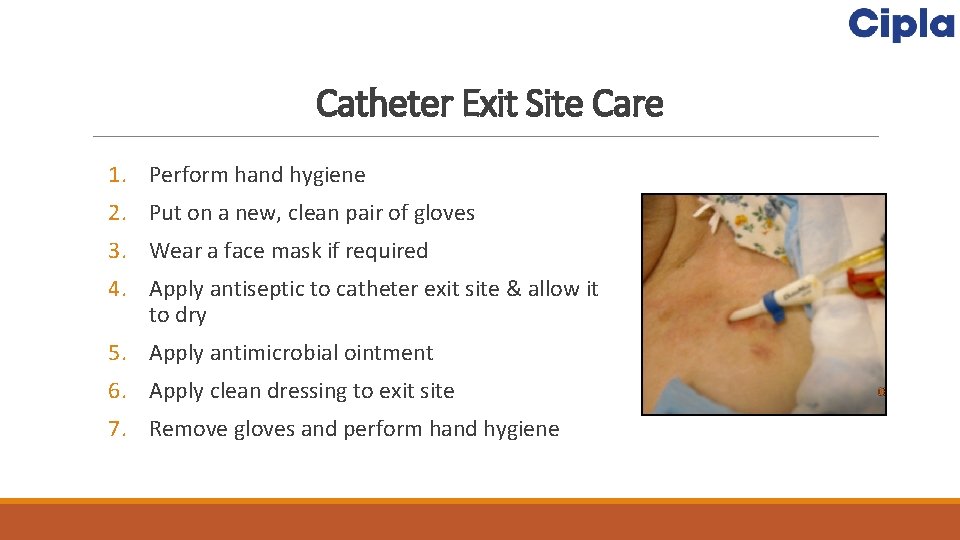 Catheter Exit Site Care 1. Perform hand hygiene 2. Put on a new, clean
