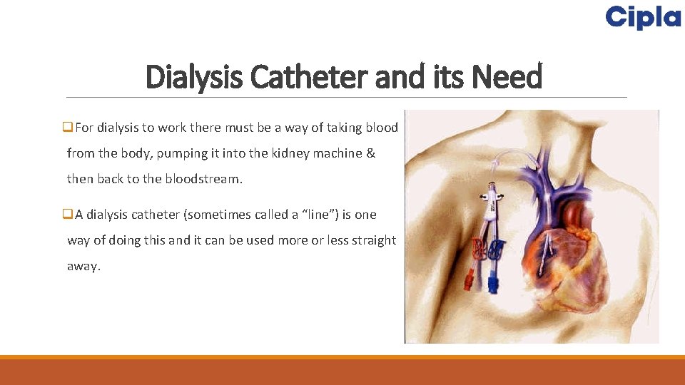 Dialysis Catheter and its Need q. For dialysis to work there must be a