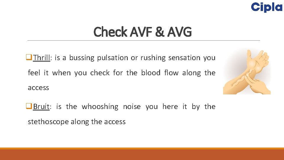 Check AVF & AVG q. Thrill: is a bussing pulsation or rushing sensation you