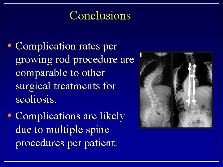 Conclusions • Complication rates per growing rod procedure are comparable to other surgical treatments