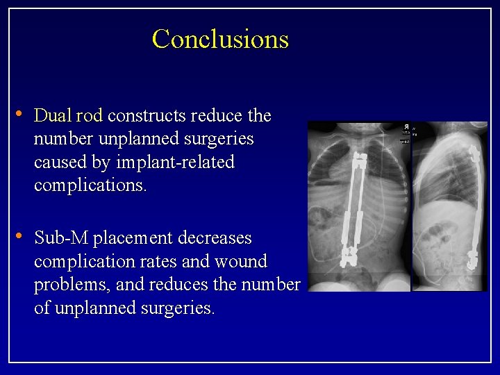 Conclusions • Dual rod constructs reduce the number unplanned surgeries caused by implant-related complications.