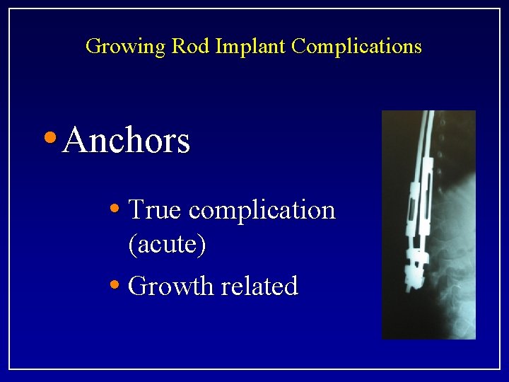 Growing Rod Implant Complications • Anchors • True complication (acute) • Growth related 