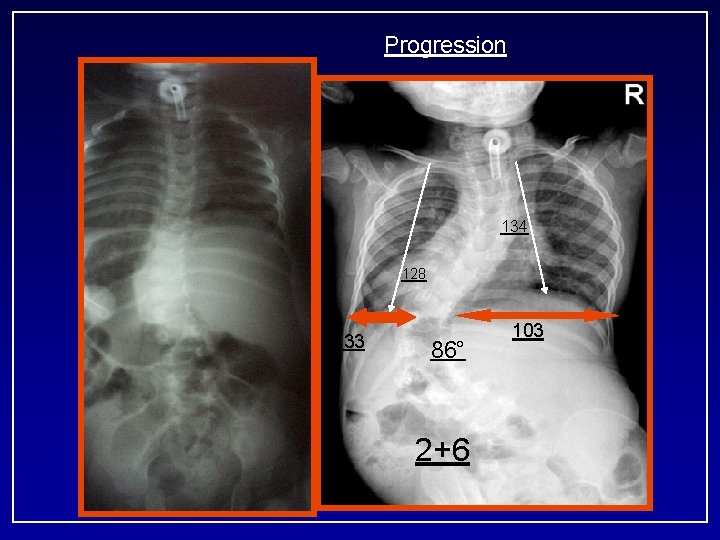 Progression 134 128 33 86° 2+6 103 