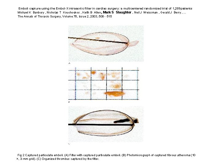 Emboli capture using the Embol-X intraaortic filter in cardiac surgery: a multicentered randomized trial