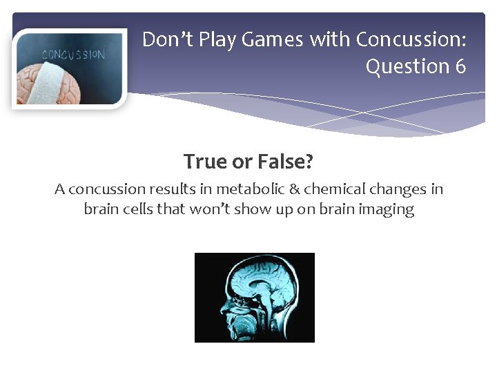 Don’t Play Games with Concussion: Question 6 True or False? A concussion results in