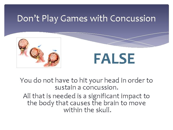 Don’t Play Games with Concussion FALSE You do not have to hit your head