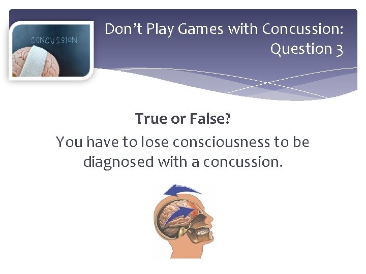Don’t Play Games with Concussion: Question 3 True or False? You have to lose