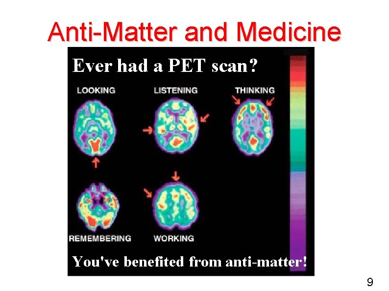 Anti-Matter and Medicine Ever had a PET scan? You've benefited from anti-matter! 9 