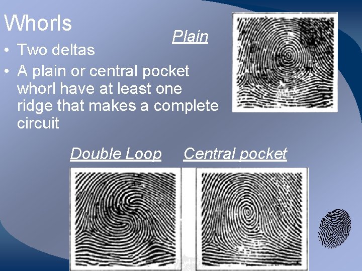 Whorls Plain • Two deltas • A plain or central pocket whorl have at