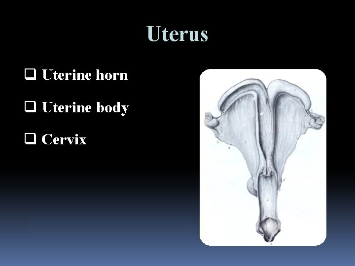 Uterus q Uterine horn q Uterine body q Cervix 