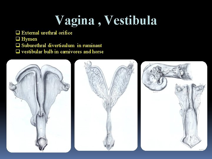 Vagina , Vestibula q External urethral orifice q Hymen q Suburethral diverticulum in ruminant