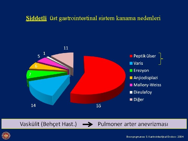 Şiddetli üst gastrointestinal sistem kanama nedenleri (Dieulafoy lezyonu; Epiteli erode ederek yüzeye ulaşan dilate