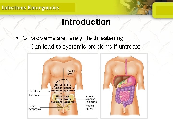 Infectious Emergencies Introduction • GI problems are rarely life threatening. – Can lead to